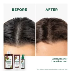 Klorane Strengthening Quinine & Organic Edelweiss Shampoo 400ml 7 Klorane Strengthening Quinine & Organic Edelweiss Shampoo 400ml -Hair Care Store Klorane Sham Quinine400ml 3