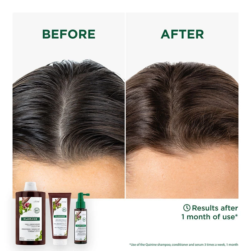 Klorane Strengthening Quinine & Organic Edelweiss Shampoo 400ml 4 Klorane Strengthening Quinine & Organic Edelweiss Shampoo 400ml - Image 4