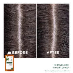 Klorane Anti-dandruff Rebalancing Shampoo With Galangal & AHA 400ml 11 Klorane Anti-dandruff Rebalancing Shampoo With Galangal & AHA 400ml -Hair Care Store P0002244 4