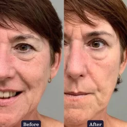 Edible Beauty Plant Collagen Plumping Serum 30ml -Hair Care Store edible beauty plant collagen plumping serum 30ml 7